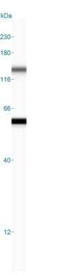 Simple Western: Cytokeratin 8 Antibody (K8/383) [NBP2-34266]