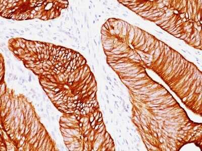 Immunohistochemistry-Paraffin: Cytokeratin 8 Antibody (K8.8) [NBP2-34269]