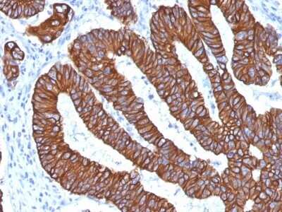 Immunohistochemistry-Paraffin: Cytokeratin 8/18 Antibody (KRT8.18/1346) - Azide and BSA Free [NBP2-54520]