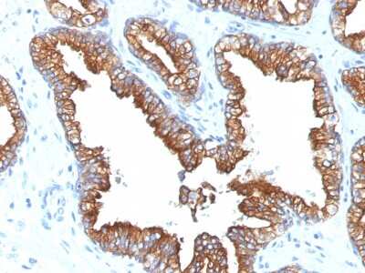 Immunohistochemistry-Paraffin: Cytokeratin 8/18 Antibody (KRT8.18/1346) - Azide and BSA Free [NBP2-54520]