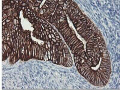 Immunohistochemistry: Cytokeratin 8 Antibody (OTI1B12) - Azide and BSA Free [NBP2-71082]