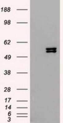 Western Blot: Cytokeratin 8 Antibody (OTI1B12)Azide and BSA Free [NBP2-71082]