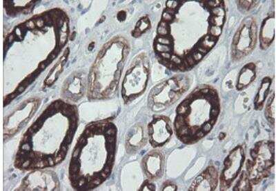 Immunohistochemistry-Paraffin: Cytokeratin 8 Antibody (OTI1B12) [NBP1-48281]