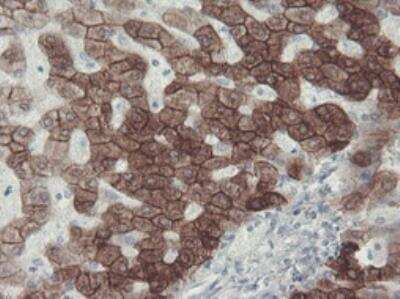 Immunohistochemistry-Paraffin: Cytokeratin 8 Antibody (OTI1B12) [NBP1-48281]