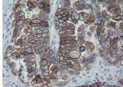 Immunohistochemistry-Paraffin: Cytokeratin 8 Antibody (OTI1B12) [NBP1-48281]