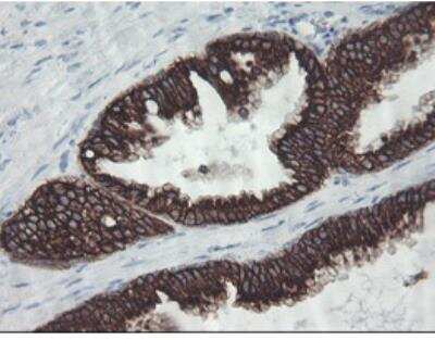 Immunohistochemistry-Paraffin: Cytokeratin 8 Antibody (OTI1B12) [NBP1-48281]
