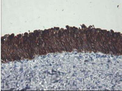 Immunohistochemistry-Paraffin: Cytokeratin 8 Antibody (OTI1B12) [NBP1-48281]