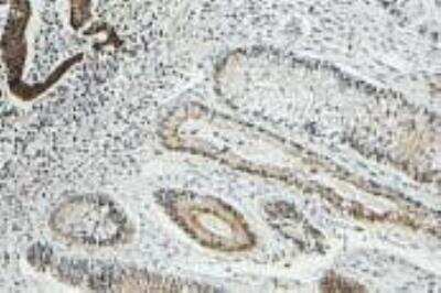 Immunohistochemistry-Paraffin: Cytokeratin 8 Antibody (OTI1B12) [NBP1-48281]