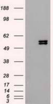Western Blot: Cytokeratin 8 Antibody (OTI1B12) [NBP1-48281]