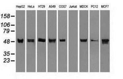 Western Blot: Cytokeratin 8 Antibody (OTI1B12) [NBP1-48281]