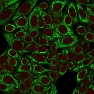 Immunocytochemistry/ Immunofluorescence: Cytokeratin 8 Antibody (SPM192) - Azide and BSA Free [NBP2-34400]