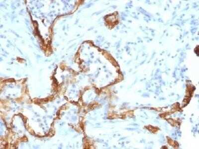 Immunohistochemistry-Paraffin: Cytokeratin 8 Antibody (SPM192) - Azide and BSA Free [NBP2-34400]