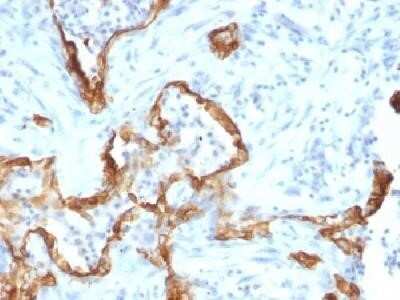 Immunohistochemistry-Paraffin: Cytokeratin 8 Antibody (SPM192) - IHC-Prediluted [NBP2-44936]