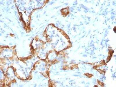 Immunohistochemistry-Paraffin: Cytokeratin 8 Antibody (SPM192) [NBP2-34352]
