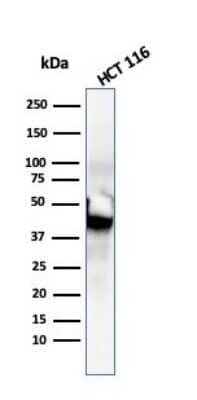 Western Blot: Cytokeratin 8 Antibody (SPM192) [NBP2-34352]