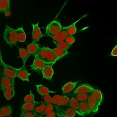 Immunocytochemistry/ Immunofluorescence: Cytokeratin 8 Antibody (SPM538) - Azide and BSA Free [NBP2-34417]