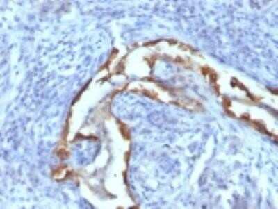 Immunohistochemistry-Paraffin: Cytokeratin 8 Antibody (SPM538) - Azide and BSA Free [NBP2-34417]