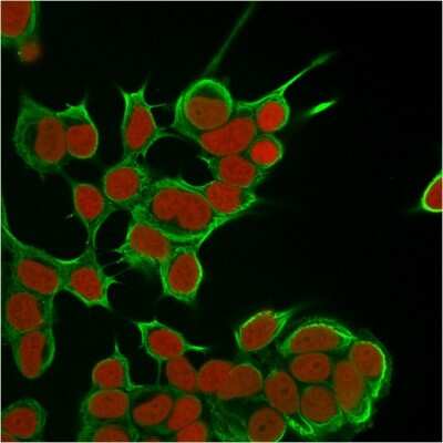 Immunocytochemistry/ Immunofluorescence: Cytokeratin 8 Antibody (SPM538) [NBP2-34370]