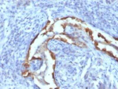 Immunohistochemistry-Paraffin: Cytokeratin 8 Antibody (SPM538) [NBP2-34370]