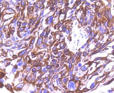 Immunohistochemistry-Paraffin: Cytokeratin 8 Antibody (SU0338) [NBP2-67468]