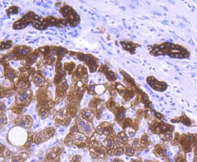 Immunohistochemistry-Paraffin: Cytokeratin 8 Antibody (SU0338) [NBP2-67468]