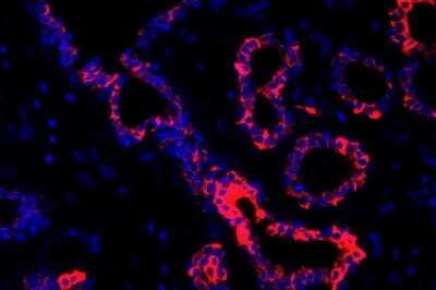 Immunohistochemistry-Paraffin: Cytokeratin 8 Antibody (SU0338) [NBP2-67468]