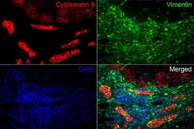 Immunohistochemistry-Paraffin: Cytokeratin 8 Antibody (SU0338) [NBP2-67468]
