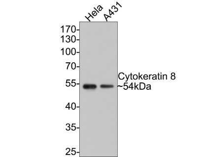 Western Blot: Cytokeratin 8 Antibody (SU0338) [NBP2-67468]