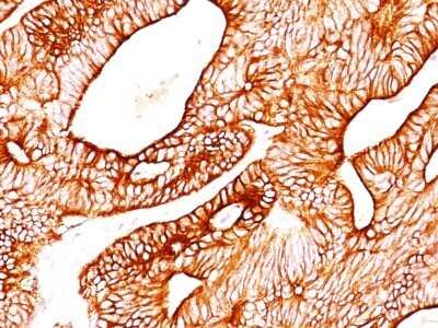 Immunohistochemistry-Paraffin: Cytokeratin 8 Antibody (TS1) - IHC-Prediluted [NBP2-44935]