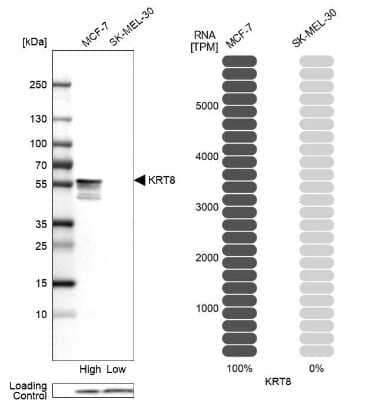 Western Blot: Cytokeratin 8 Antibody [NBP2-14177]