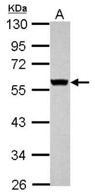Western Blot: Cytokeratin 8 Antibody [NBP2-16094]
