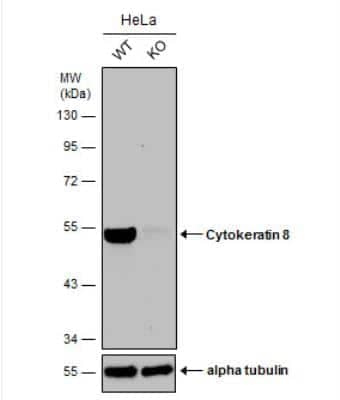 Knockout Validated: Cytokeratin 8 Antibody [NBP2-16094]