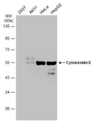 Western Blot: Cytokeratin 8 Antibody [NBP2-16094]