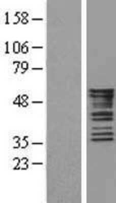 Western Blot: Cytokeratin 8 Overexpression Lysate [NBL1-12397]