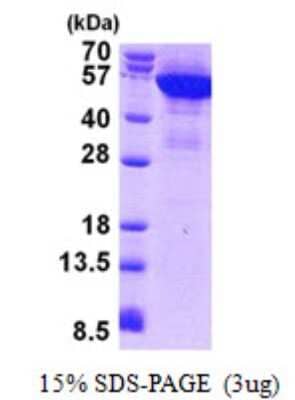 SDS-PAGE: Recombinant Human Cytokeratin 8 His Protein [NBP2-23166]