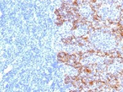 Immunohistochemistry-Paraffin: Cytokeratin, Acidic (Type I or LMW) Antibody (SPM115) - Azide and BSA Free [NBP2-34393]