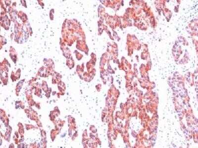 Immunohistochemistry-Paraffin: Cytokeratin, Basic (Type II or HMW) Antibody (SPM116) - IHC-Prediluted [NBP2-44439]
