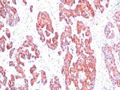 Immunohistochemistry-Paraffin: Cytokeratin, Basic (Type II or HMW) Antibody (SPM116) [NBP2-34348]