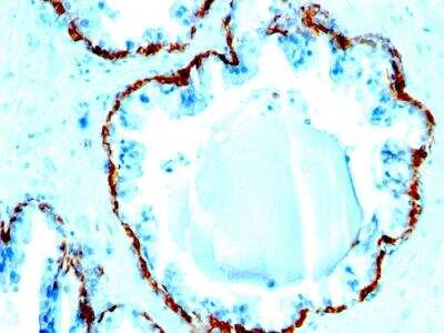 Immunohistochemistry-Paraffin: Cytokeratin, Basic (Type II or HMW) Antibody (SPM591) - IHC-Prediluted [NBP2-48220]