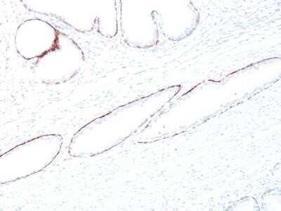 Immunohistochemistry-Paraffin: Cytokeratin, HMW Antibody (34BE12) - Azide and BSA Free [NBP2-34533]