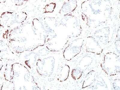 Immunohistochemistry-Paraffin: Cytokeratin, HMW Antibody (34BE12) - Azide and BSA Free [NBP2-34533]