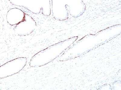 Immunohistochemistry-Paraffin: Cytokeratin, HMW Antibody (34BE12) [NBP2-34340]