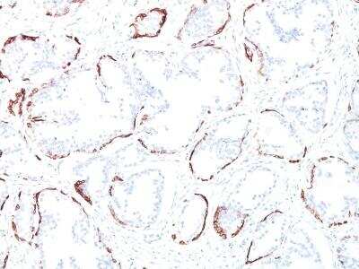Immunohistochemistry-Paraffin: Cytokeratin, HMW Antibody (34BE12) [NBP2-34340]