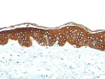 Immunohistochemistry-Paraffin: Cytokeratin, HMW Antibody (AE-3) - Azide and BSA Free [NBP2-33170]