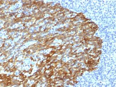 Immunohistochemistry-Paraffin: Cytokeratin, HMW Antibody (DE-SQ) - Azide and BSA Free [NBP3-08718]