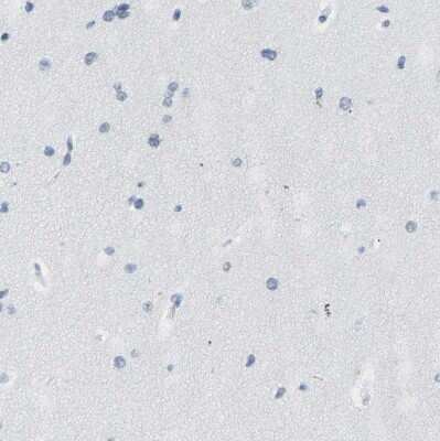 Immunohistochemistry-Paraffin: Cytokeratin, HMW Antibody [NBP1-81648]