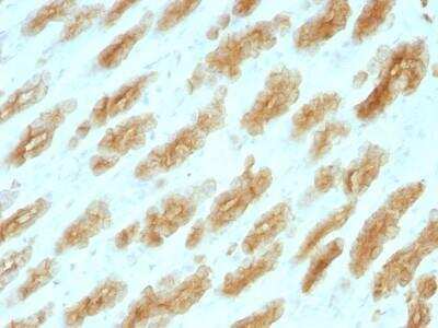 Immunohistochemistry-Paraffin: Cytokeratin, HMW Antibody (KRTH/1076) - Azide and BSA Free [NBP2-47690]
