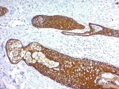 Immunohistochemistry-Paraffin: Cytokeratin, HMW Antibody (KRTH/1076) - Azide and BSA Free [NBP2-47690]