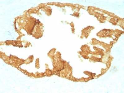 Immunohistochemistry-Paraffin: Cytokeratin, HMW Antibody (KRTH/1076) [NBP2-44440]