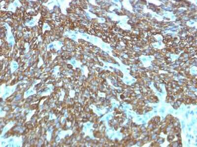 Immunohistochemistry-Paraffin: Cytokeratin, HMW Antibody (KRTH/1576R) - Azide and BSA Free [NBP2-54589]